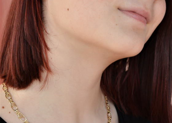 Souprava zlatá – blizna